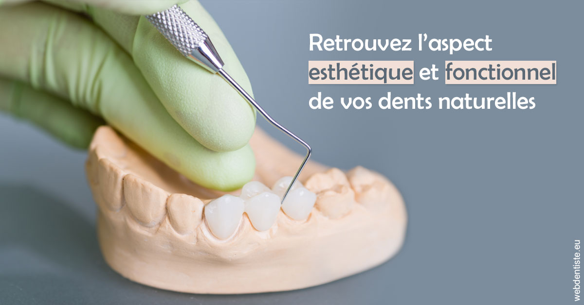 https://dr-nicolas-goossens.chirurgiens-dentistes.fr/Restaurations dentaires 1