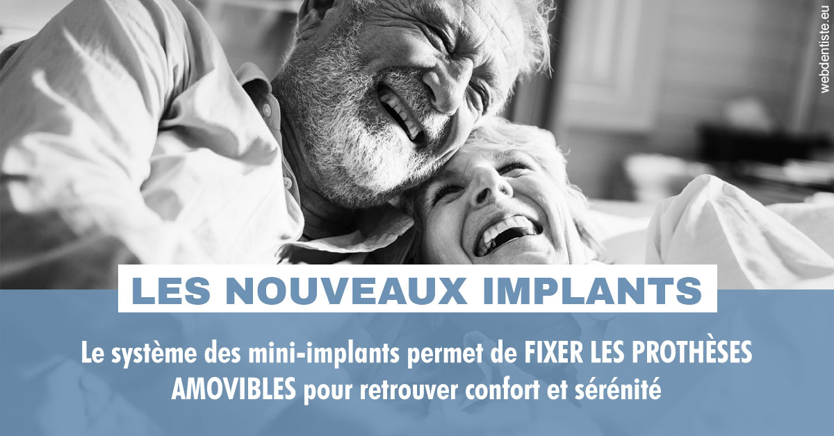 https://dr-nicolas-goossens.chirurgiens-dentistes.fr/Les nouveaux implants 2