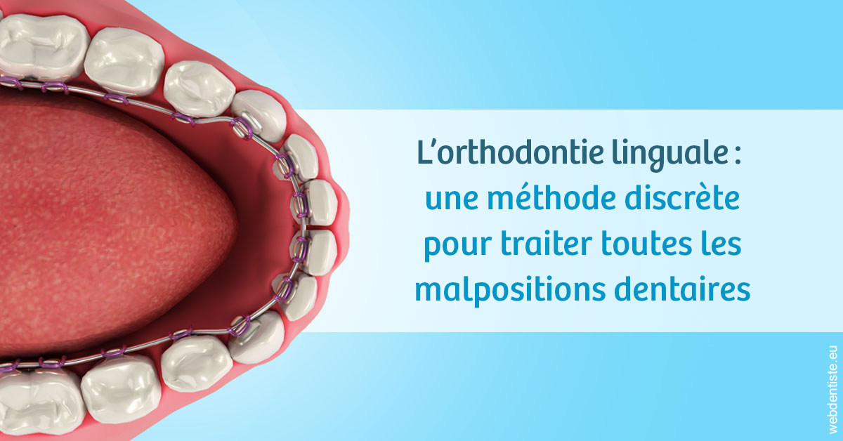 https://dr-nicolas-goossens.chirurgiens-dentistes.fr/L'orthodontie linguale 1