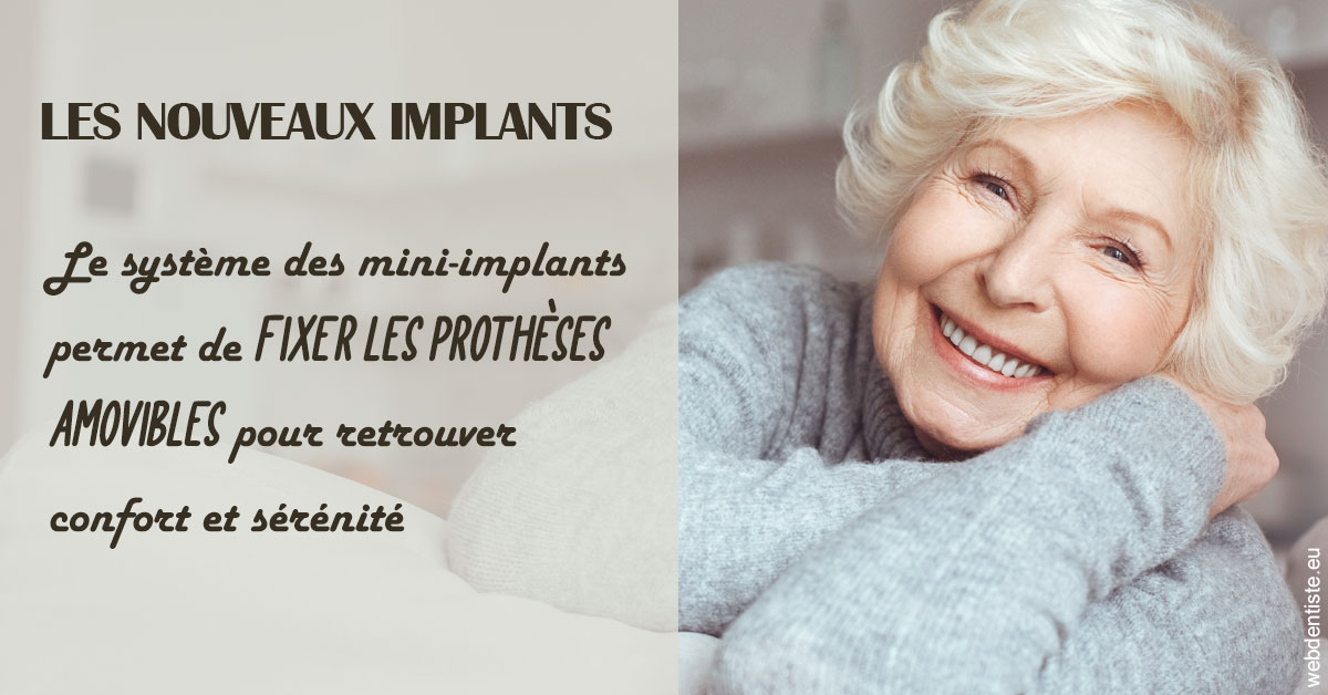 https://dr-nicolas-goossens.chirurgiens-dentistes.fr/Les nouveaux implants 1