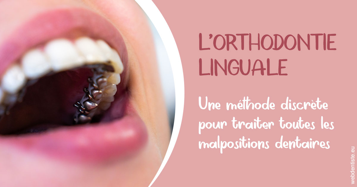https://dr-nicolas-goossens.chirurgiens-dentistes.fr/L'orthodontie linguale 2