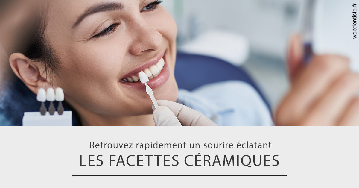https://dr-nicolas-goossens.chirurgiens-dentistes.fr/Les facettes céramiques 2