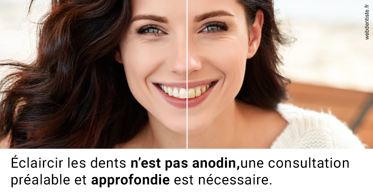 https://dr-nicolas-goossens.chirurgiens-dentistes.fr/Le blanchiment 2