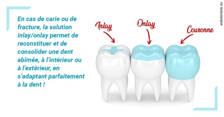 https://dr-nicolas-goossens.chirurgiens-dentistes.fr/L'INLAY ou l'ONLAY