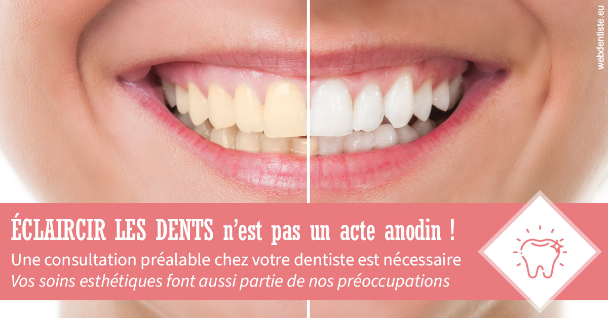 https://dr-nicolas-goossens.chirurgiens-dentistes.fr/Eclaircir les dents 1