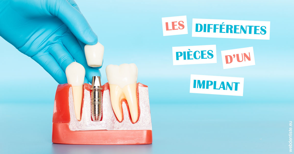 https://dr-nicolas-goossens.chirurgiens-dentistes.fr/Les différentes pièces d’un implant 2