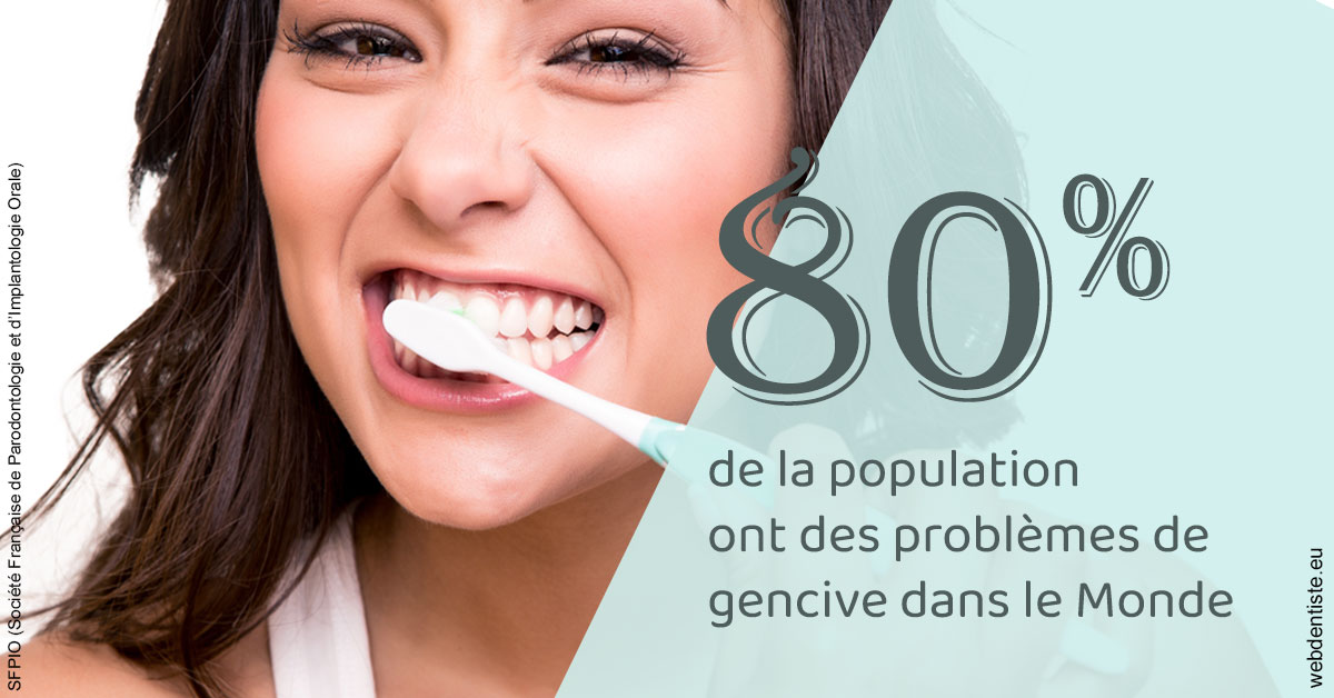 https://dr-nicolas-goossens.chirurgiens-dentistes.fr/Problèmes de gencive 1