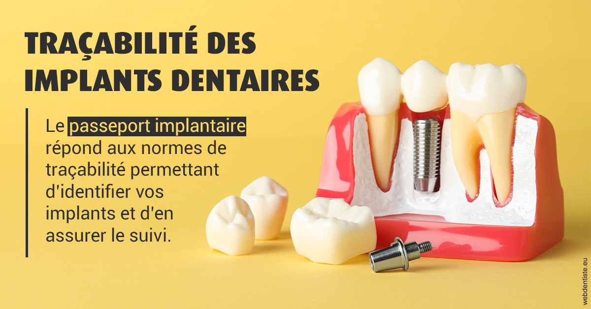 https://dr-nicolas-goossens.chirurgiens-dentistes.fr/T2 2023 - Traçabilité des implants 2