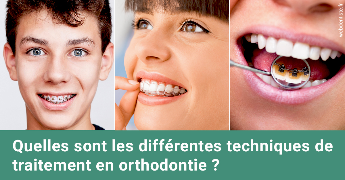 https://dr-nicolas-goossens.chirurgiens-dentistes.fr/Les différentes techniques de traitement 2
