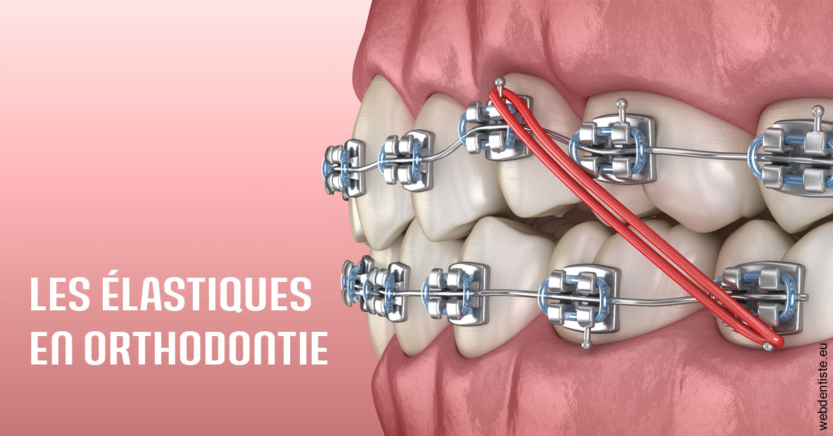 https://dr-nicolas-goossens.chirurgiens-dentistes.fr/Elastiques orthodontie 2