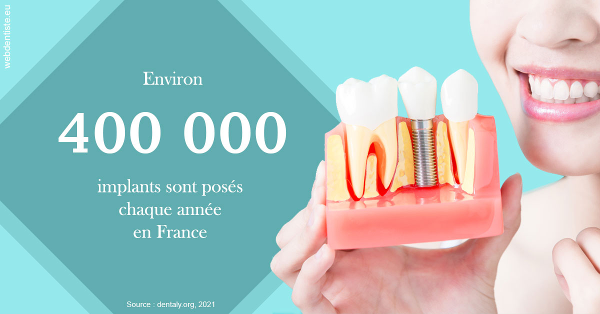 https://dr-nicolas-goossens.chirurgiens-dentistes.fr/Pose d'implants en France 2