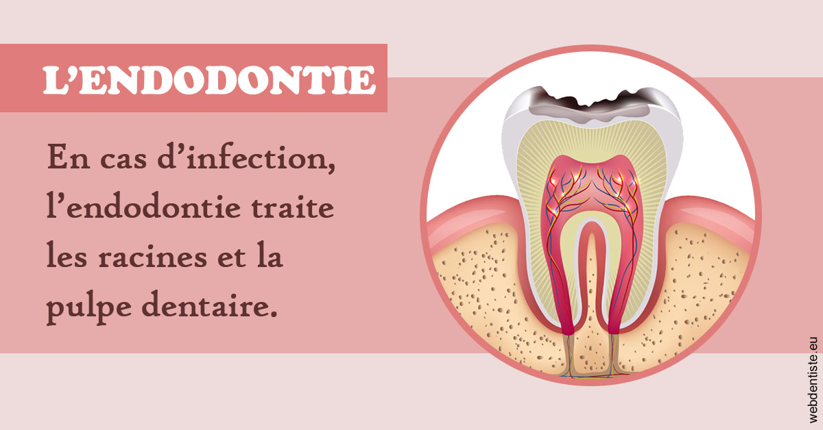 https://dr-nicolas-goossens.chirurgiens-dentistes.fr/L'endodontie 2